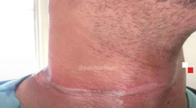foto70548
